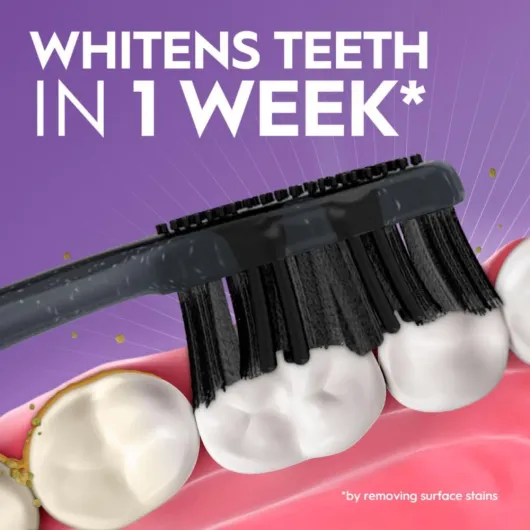 61imFT-KCBL._AC_SL1000_